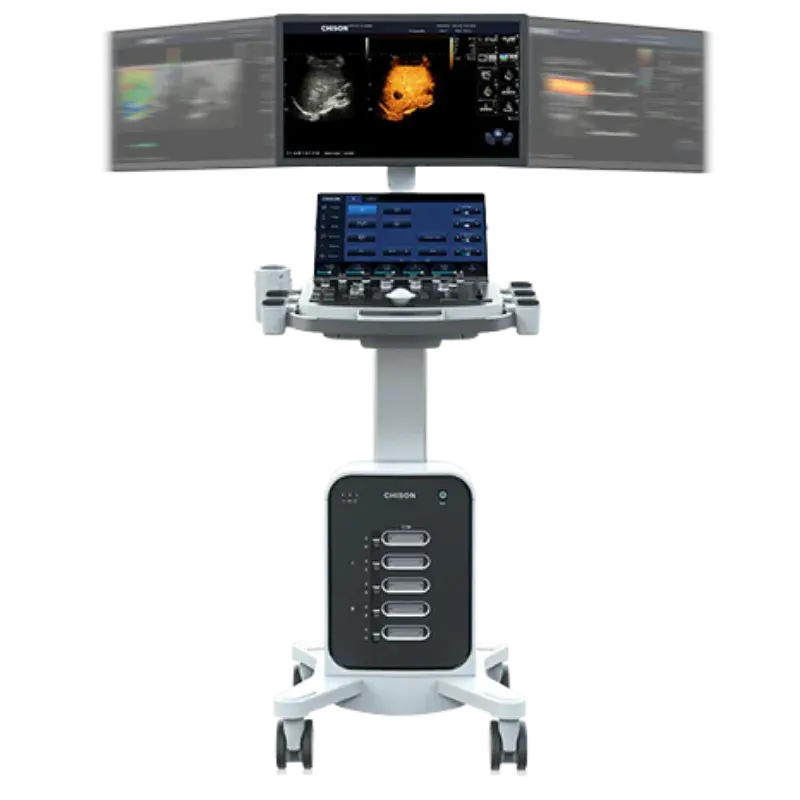 ECÓGRAFO ESTACIONARIO SONOMAX 7 (CHISON)