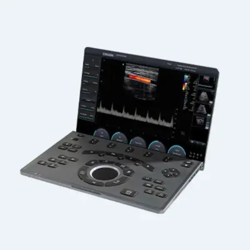 ECÓGRAFO PORTÁTIL SONOAIR 30 (CHISON)