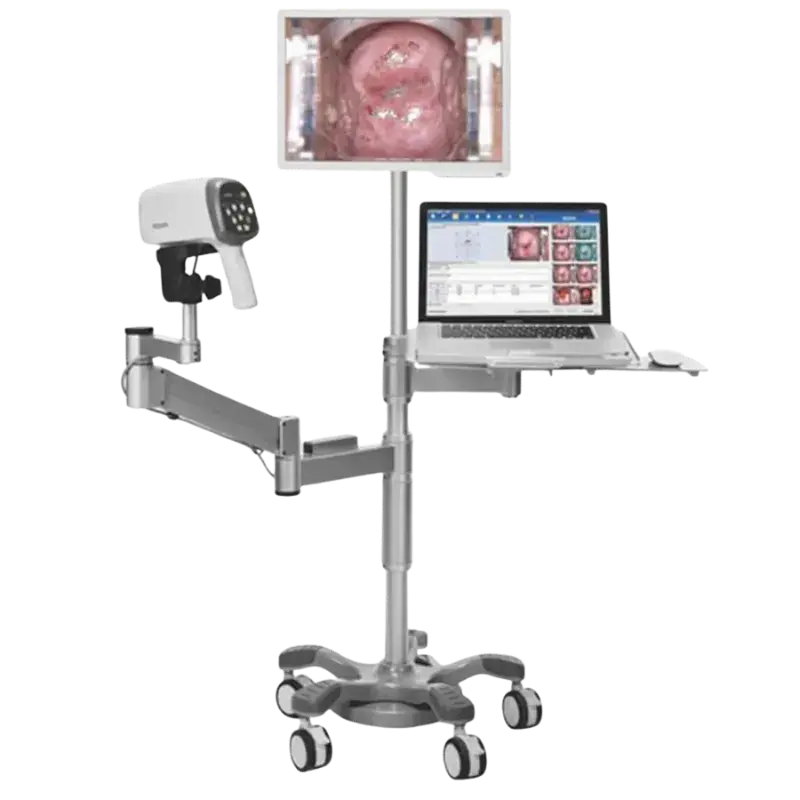 VIDEOCOLPOSCOPIO (EDAN)